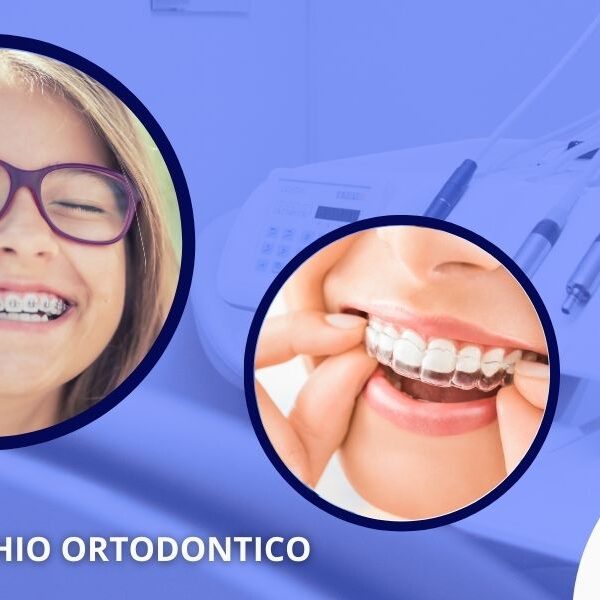 Apparecchi dentali trasparenti Versilia Lucca Studio Dentistico Massimo Casarosa