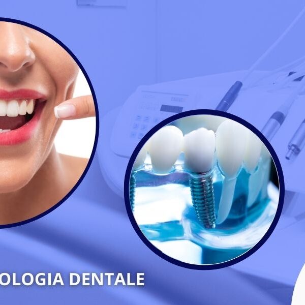 Dentista specializzato implantologia dentale Forte dei Marmi Studio Dentistico Massimo Casarosa