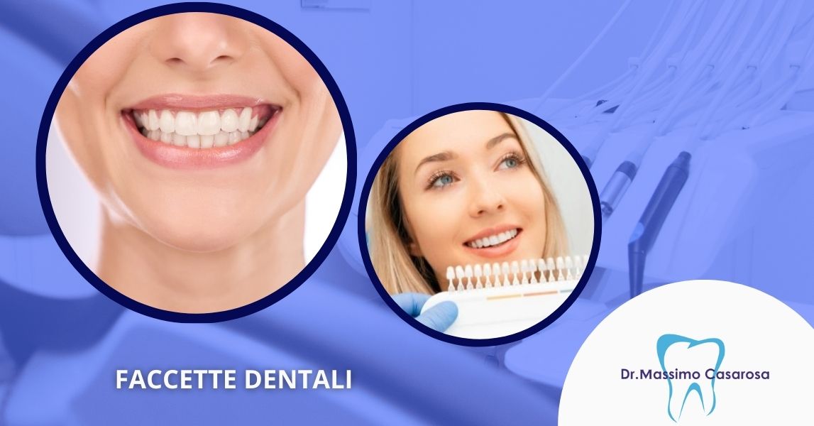 Faccette dentali in ceramica Versilia Lucca Studio Dentistico Massimo Casarosa Faccette dentali in ceramica Versilia Lucca Studio Dentistico Massimo Casarosa