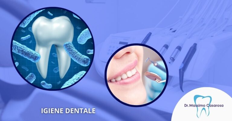 Pulizia denti professionale Versilia Lucca Studio Dentistico Massimo Casarosa