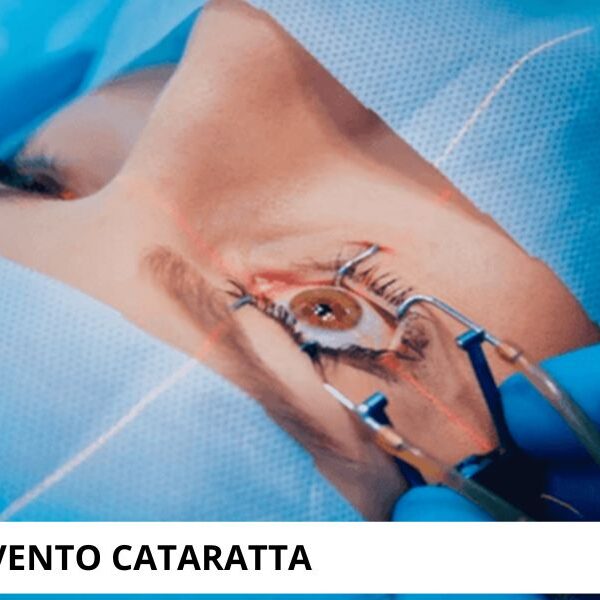 Trattamenti cataratta interventi a Viareggio Lucca da Studio Oculistico Romagnoli