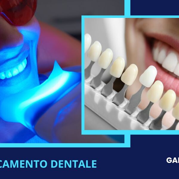 Sbiancamento dentale a Forte dei Marmi Lucca da Galleni Dr Federico