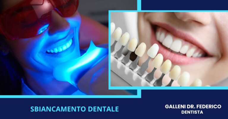 Sbiancamento dentale a Forte dei Marmi Lucca da Galleni Dr Federico